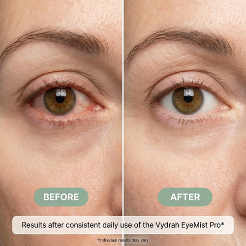 Vydrah EyeMist Pro
